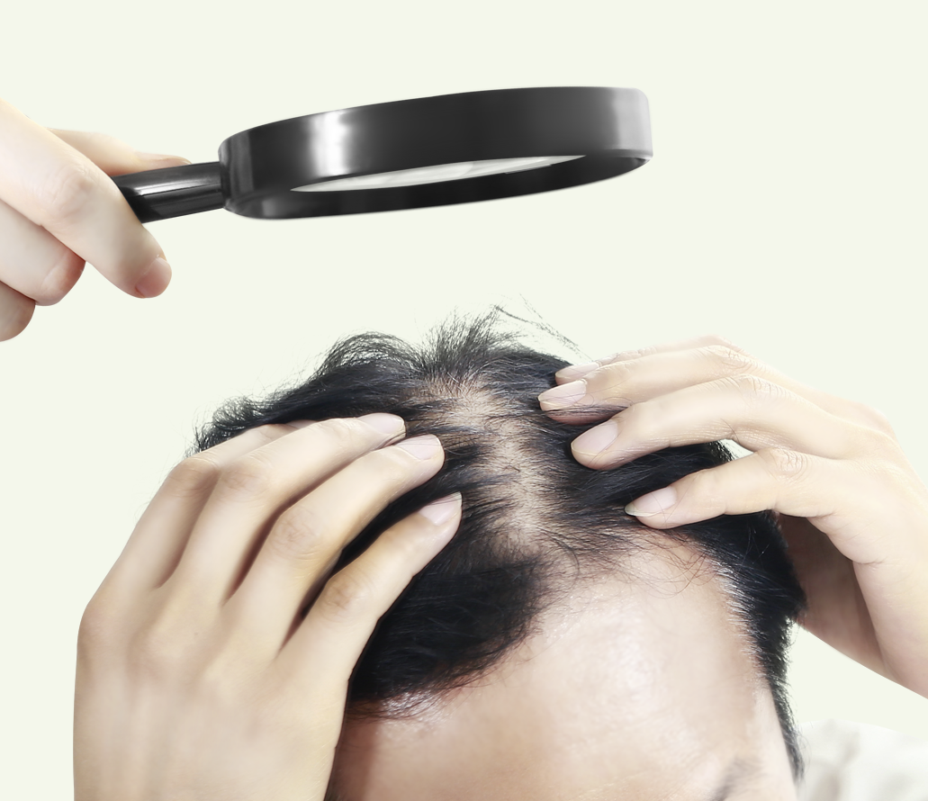 hair loss treatment korea